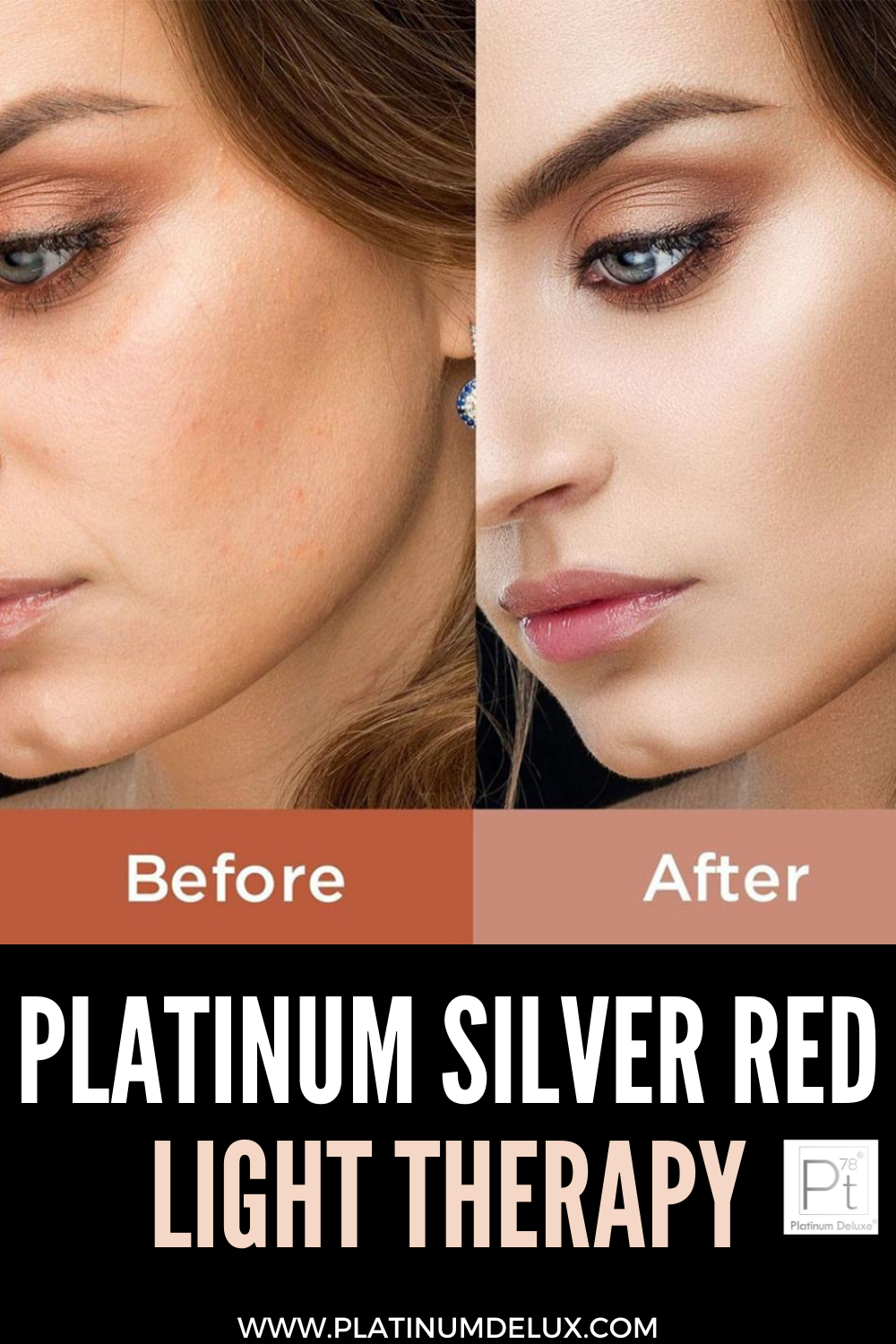 Platinum Silver Red Light Therapy